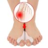 Hallux valgus tåspridare - separerar tårna - stöd